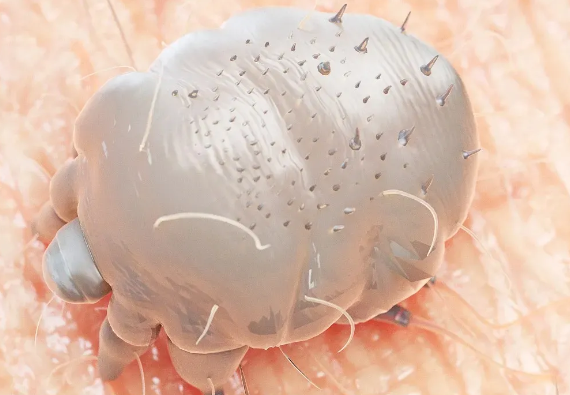 阿司匹林能去除螨虫吗 阿司匹林能去除螨虫吗