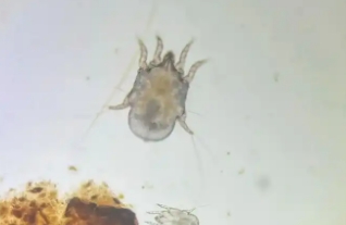 显微镜看螨虫要多少倍 显微镜看螨虫要多少倍