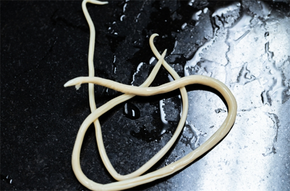 小孩蛔虫的症状有哪些