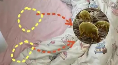 床上真的有很多螨虫吗