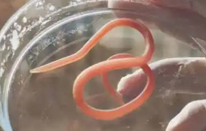 怎么确定小孩有没有蛔虫