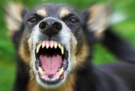 恶犬伤人,为何狗主人总能隐身? 恶犬伤人,为何狗主人总能隐身?