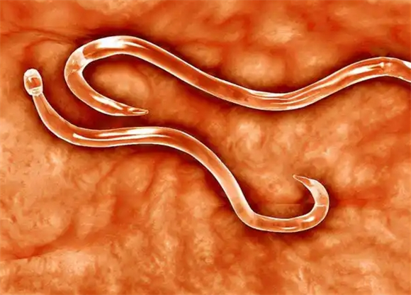 没有蛔虫可以吃蛔虫药吗 没有蛔虫可以吃蛔虫药吗