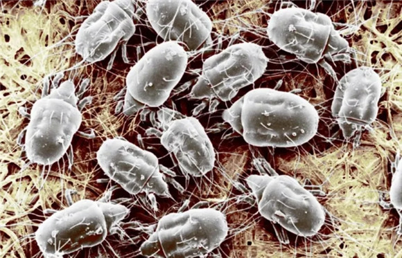 床上很痒是不是有螨虫