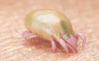 床单上有螨虫怎么去除
