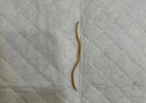 小时候蛔虫的药叫什么