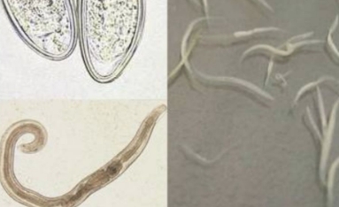 蛲虫和蛔虫有什么区别 蛲虫和蛔虫有什么区别