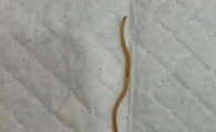 肛门里有蛔虫怎么办