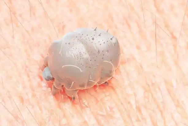 床上的螨虫怎么消灭掉 床上的螨虫怎么消灭掉