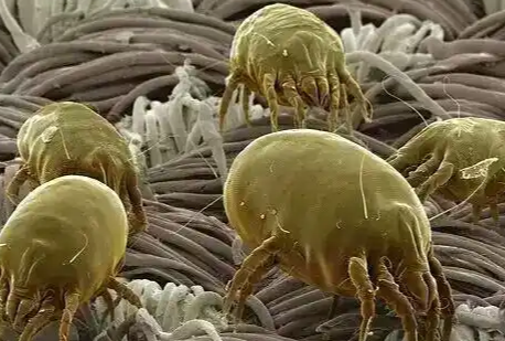 鼻梁上有螨虫怎么去除 鼻梁上有螨虫怎么去除