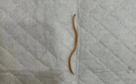 死了的蛔虫是什么样子
