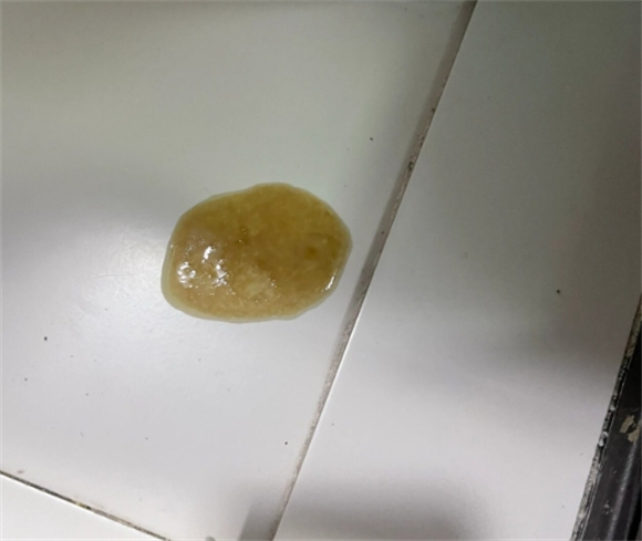 猫拉屎末端总是一点稀是咋回事啊