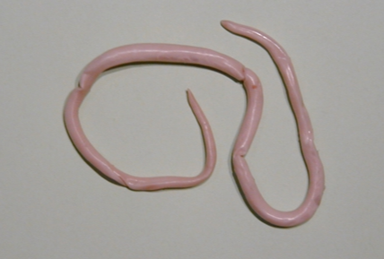 幼儿蛔虫症状有哪些 幼儿蛔虫症状有哪些