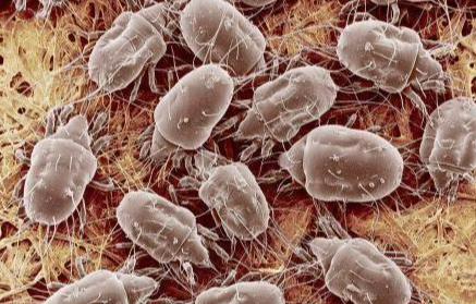 床上螨虫用什么药最好 床上螨虫用什么药最好