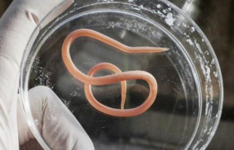 如何看宝宝有没有蛔虫 如何看宝宝有没有蛔虫