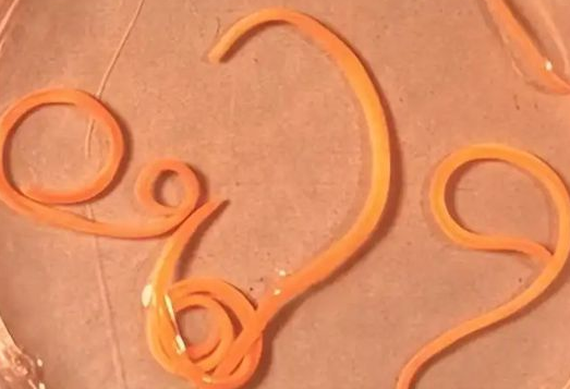 蛔虫的形态结构特点