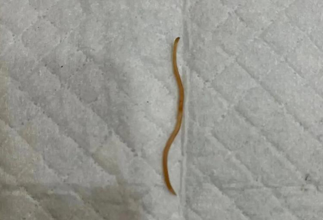 死了的蛔虫是什么样子