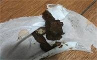 猫大便有密密麻麻白色虫是咋了