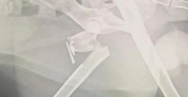 小姐姐发现一只被苍蝇包围的流浪猫,幸好小姐姐比死神先来到 小姐姐发现一只被苍蝇包围的流浪猫,幸好小姐姐比死神先来到