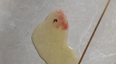 狗狗尿血了严重吗? 狗狗尿血了严重吗?
