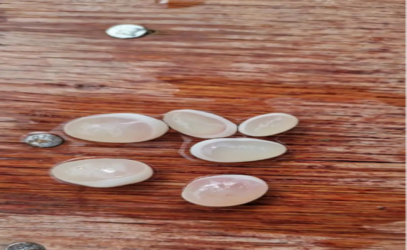 青鱼头里面一粒一粒的是什么