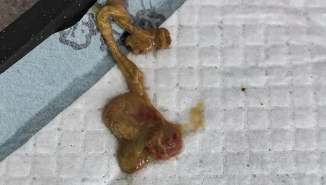 狗狗软便带血怎么办 狗狗软便带血怎么办