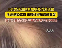 郑州6岁女孩摸流浪猫头皮先痒后秃，去医院查出猫带真菌感染