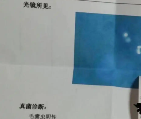 郑州6岁女孩摸流浪猫头皮先痒后秃，去医院查出猫带真菌感染