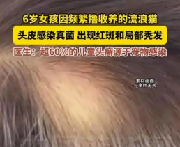 郑州6岁女孩摸流浪猫头皮先痒后秃，去医院查出猫带真菌感染